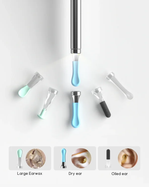 Xiaomi Bebird R1 – Limpiador de Oídos con Cámara HD 📷 | Nueva Versión Mejorada™
