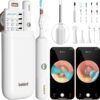 Cuida Tu Audición con Otoscopio Digital Bebird Earth Sith Plus 👂Limpieza Precisa con Cámara HD ™