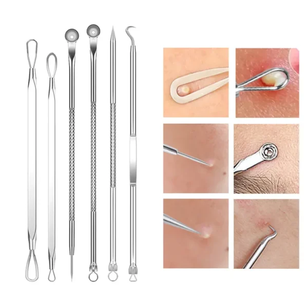 Kit Removedor de Espinillas y Puntos Negros – Agujas Faciales y Pinzas de Precisión Antiacné™