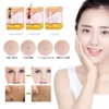 PLASMA PEN REMOVEDOR DE LUNARES, PECAS, VERRUGAS, ACROCORDONES™