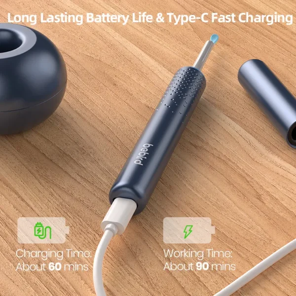 👂 Descubre lo que no puedes ver: Otoscopio Xiaomi Bebird M9s con Cámara HD™