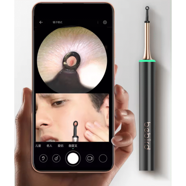 🆕 Xiaomi Bebird T15 – Limpia Oídos y Extractor de Acné 2 en 1 ✨ Higiene Inteligente con Cámara HD™