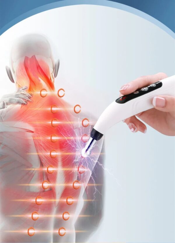 WhatsApp Image 2025-12-17 at 17.43.49 (1) Pluma de Acupuntura Portátil Alivio Natural e Inmediato del Dolor Muscular Estimula, Relaja Músculos, Reduce Estrés™