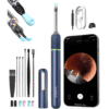 🔍 Limpieza Precisa Note 5 🎯 Extrae lo imposible: Otoscopio con Cámara y Pinza Inteligente™