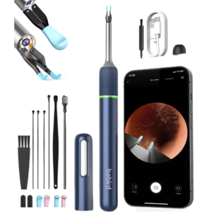 🔍 Limpieza Precisa Note 5 🎯 Extrae lo imposible: Otoscopio con Cámara y Pinza Inteligente™