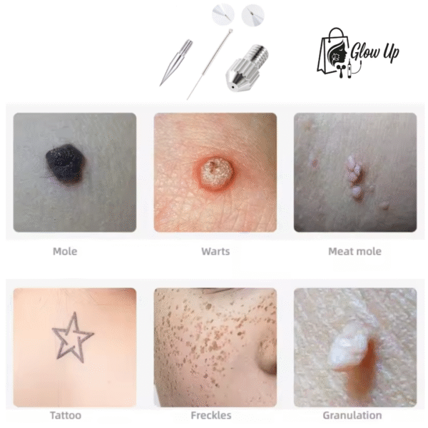 12 - copia x25 Agujas Finas Plasma Pen Original 20 Finas 3 Gruesas + 2 Seguros