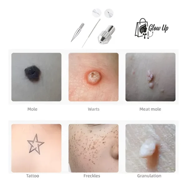 descarga (4) Kit X100 Repuesto Plasma Mole + x3 Gruesas y x2 seguros De Regalo